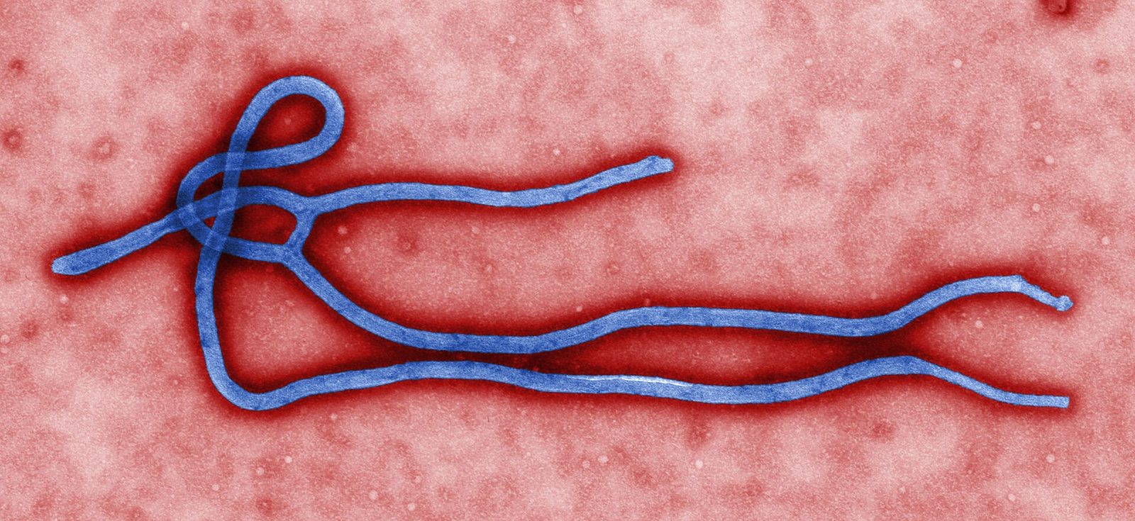 Ebola en RDC : Kinshasa annonce 159 décès et 622 cas suspects, l'épidémie d'Ituri prend une ampleur préoccupante